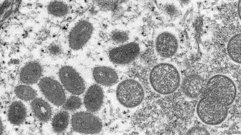 යුරෝපයේ ව්‍යාප්තවෙමින් පවතින Monkeypox රෝගය…