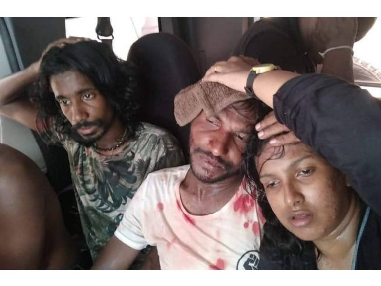 පොහොට්ටු ප්‍රහාරයෙන් තුවාල ලැබූවන් 17 ක් දක්වා ඉහළට