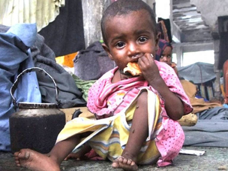 ළමා මන්දපෝෂණයෙන් ලංකාව වේගයෙන් ඉදිරියට, ලෝකයේ 07 වෙනි තැන, කලාපයේ 02 වෙනි තැන !