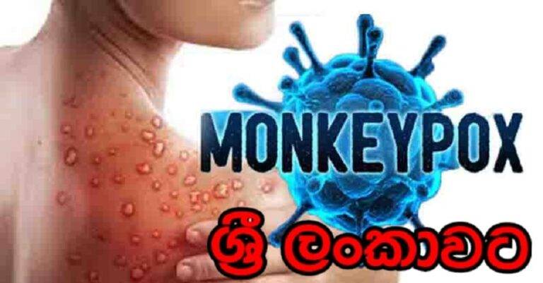 වඳුරු උණ ( Monkeypox)  ශ්‍රී ලංකාවට !!