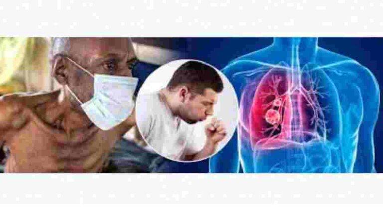 ක්ෂයරෝගය තුරන් කරමු…