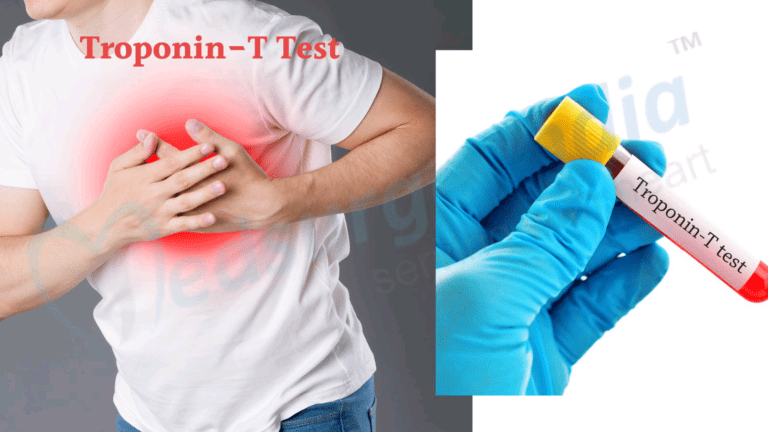 ඉන්දියාවෙන් ගෙන්වූයේ බාල ට්‍රොපනින් (Tropanin 1) පරීක්‍ෂණ කට්ටල ද ?