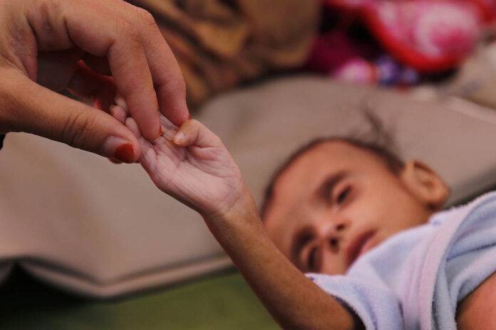 Image: Ongoing conflict effects on more Yemen children