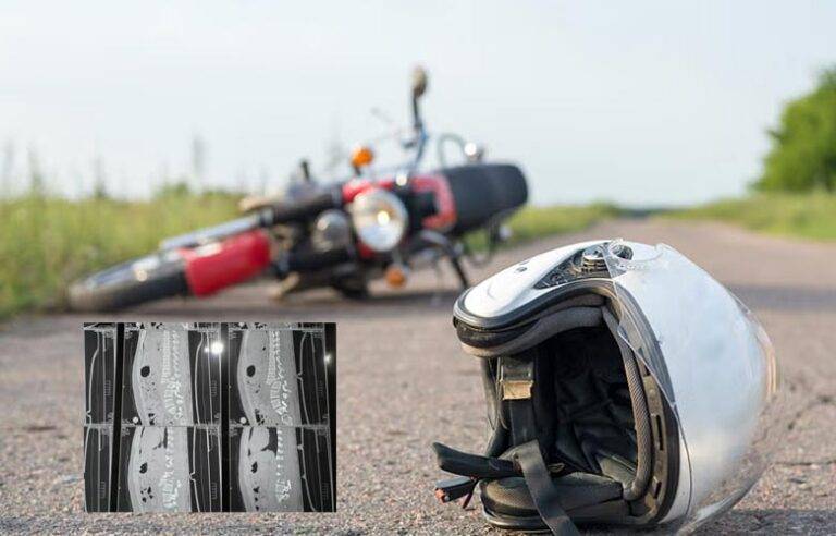 Bike එක උඩ ඉඳන් ලෝකෙට හිනාවෙන්න, ඒත් ආරක්ෂිතව – වෛද්‍යවරයකුගේ සංවේදී සටහනක්