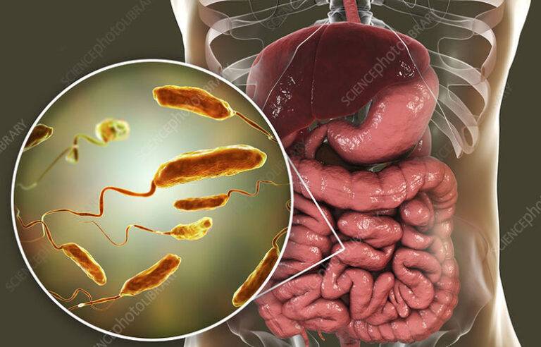 පාකිස්ථානයේ කොළරා රෝගීන් ඉහළ යාමේ අවදානමක්